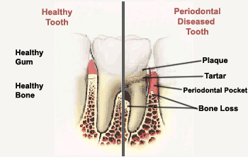 smelly teeth and gums